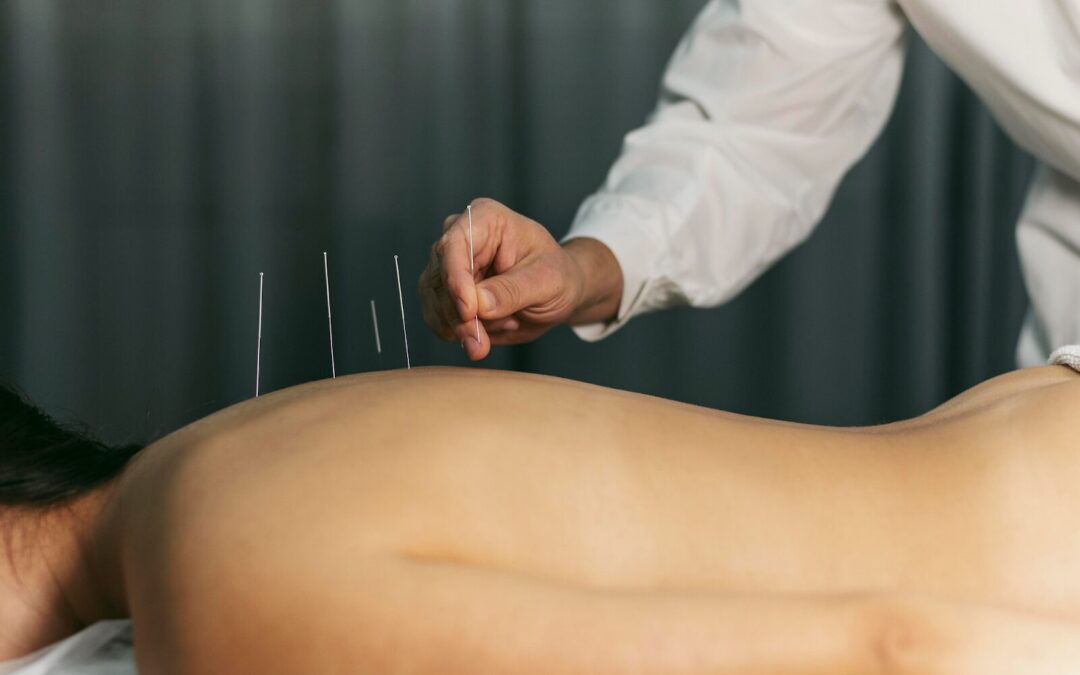 What Conditions Can Acupuncture Help Treat?